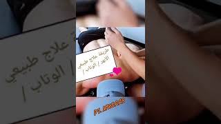 طريقة علاج الطبيعي للوتاب👍🏻