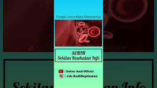 Fungsi Sebenarnya Lensa Mata #LensaMata #Softlens #KesehatanMata