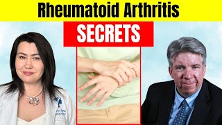 Dr. John Cush Reveals the Hidden Dangers of Rheumatoid Arthritis You Need to Know