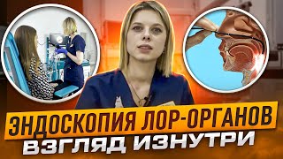 Как проводится эндоскопическое исследование ЛОР-органов?