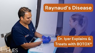 Understanding Raynaud's Disease: Dr. Iyer on How Botox Can Help