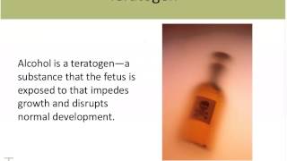 MOFAS: Fetal Alcohol Spectrum Disorder Basics Webinar