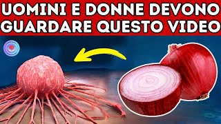 ATTENZIONE! CIPOLLE CRUDE: Fai Attenzione! Anche Solo Una Può Causare Una Reazione IRREVERSIBILE