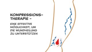 Kompressionstherapie - Ein wichtiger bestandteil der Behandlung der meisten wunden am unterschenkel