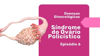 O Que é a Síndrome do Ovário Policístico? Descubra Aqui! | Dr. Pedro Doria