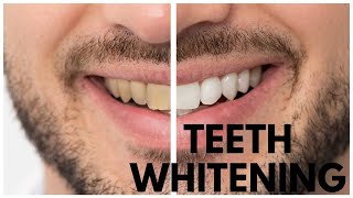 TEETH WHITENING AT HOME | 3 NATURAL WAYS | 100% EFFECTIVE  | DIY