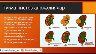 БУЙРАК АНОМАЛИЯЛАРИ (НУҚСОНЛАРИ)