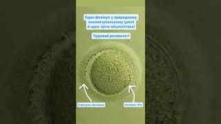 A mature human oocyte. Зріла яйцеклітина людини. #oocyte #embrio #ivf #icsi #biology #science