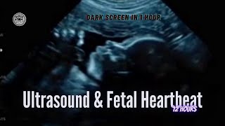 Ultrasound and Fetal Heartbeat ⨀ Soothing Sleep Sounds for Relaxation and Comfort