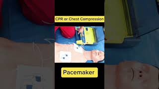 CPR or Chest Compression|Heart Pacemaker💕😱#trendingshorts#shortvideo#shortfeed#shorts#trending#heart