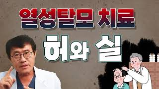 열성탈모 치료의 허와 실