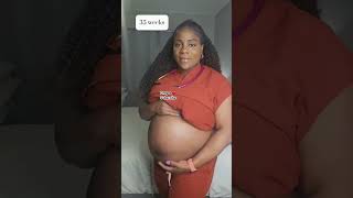 Pregnancy growth 👉🏽 Postpartum #shorts #pregnany #goviral #belly #viral #foryou #fypシ