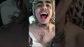 Lil pump got his braces off !