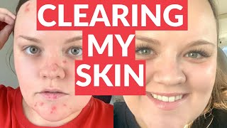 Balance by Alani Nu Review - Dermatillomania/Skin Picking Disorder.