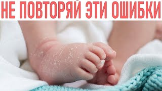 ПРИЧИНЫ ШЕЛУШЕНИЯ КОЖИ У МАЛЕНЬКИХ ДЕТЕЙ  | Что делать если у ребенка облазит кожа