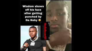 #dababy artist #wisdom shows off his #face after the #fight against #dababy