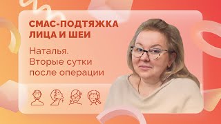 Наталья. СМАС. 2 сутки после операции