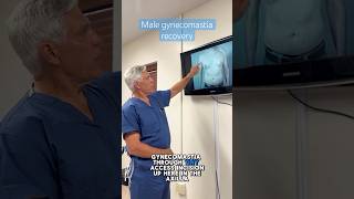 Male plastic surgery expert Dr. Parker on Gynecomastia aftercare #gynecomastiacost #paramusnj #nj