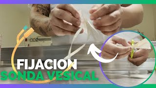 ¿Como HACER una FIJACION PARA SONDA VESICAL? | Con 2 MATERIALES | Enfermeria