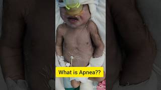 Is this baby in Apnea? #youtubeshorts #shorts #shortvideo