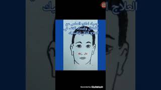 علاج العطس وانسداد الانف عند الاطفال العلاج الذاتي بالتدليك