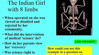 can sociology be a science - girls with 8 limbs