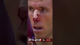 Common injuries in Basketball 🏀