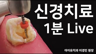 치통 심할때 하는 신경치료, 크라운 과정 [1분 Live]