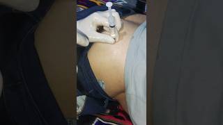 intramuscular injection. injection into the gluteal muscle