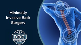 Transforming Back Pain: Minimally Invasive Surgery Explained | Ask the Doc: No Appointment Needed