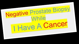 Does Prostate Biopsy Accurate Enough Because It was Negative While I have Cancer?