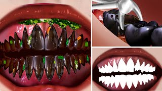 ASMR Clean Dirty Teeth & Deep tooth extraction | Deep Cleaning Animation