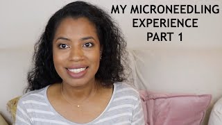 Microneedling Stretch Marks Experience  Part1