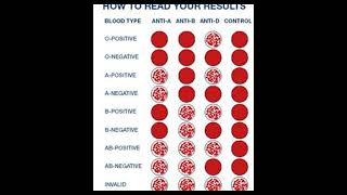 Blood groups Types, find your  #medicine #healthcareequipment #medicalequipment