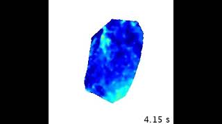 Optical mapping of cardiac electromechanics in beating in vivo hearts