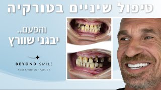 טיפולי שיניים בטורקיה עם ביונד סמייל - שיקום מלא בטורקיה של יבגני