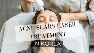 Acne Scars Laser Treatment: Remove Dark Spots, Moles, and more! | Clear Skin Procedure