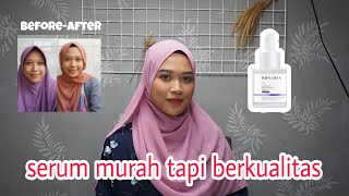 Implora Luminous Brightening Serum di kulit normal kering selama 3 minggu