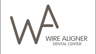 Vive el cambio de tu sonrisa con Wire Aligner