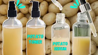 Potato to treat pigmentation, dark spots, acne scars | Potato face spray | Potato face serum