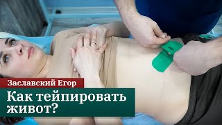 Тейпирование при диастазе и расхождении пупочного кольца. Заславский Егор