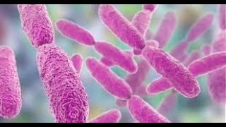 Long Term Trends of Clinical Distribution and Resistance Patterns of Klebsiella pneumoniae