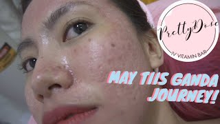 CO2 FRACTIONAL LASER S#2 and S#3 at PRETTYDOSE | alayzamaylao