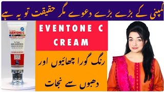 Eventonec cream How To Use, Side Effects In Detail Honest Review