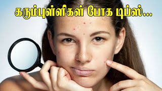 கரும்புள்ளிகள் போக சில டிப்ஸ்...| How to Remove Dark Spots in the Face Beauty