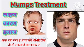 गलसुआ का इलाज | Mumps Treatment In Hindi | Mumps क्या है, कारण, लक्षण, इलाज | Mumps - Causes,Symptom