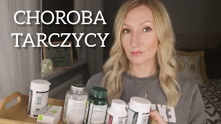 CHOROBA TARCZYCY | BADANIA | LECZENIE | GUZY | MOJA HISTORIA