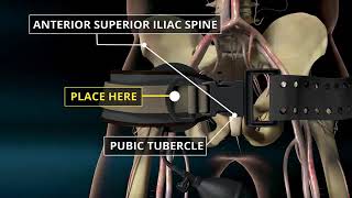 CMC 19 SAM Junctional Tourniquet SJT