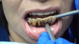 DENTIST *LIVE* QnA (Ask me anything)