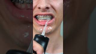 Using a power washer to floss my teeth!😱😱